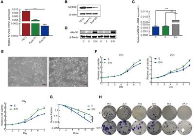 NRAGE Confers Radiation Resistance in 2D and 3D Cell Culture and Poor Outcome in Patients With Esophageal Squamous Cell Carcinoma